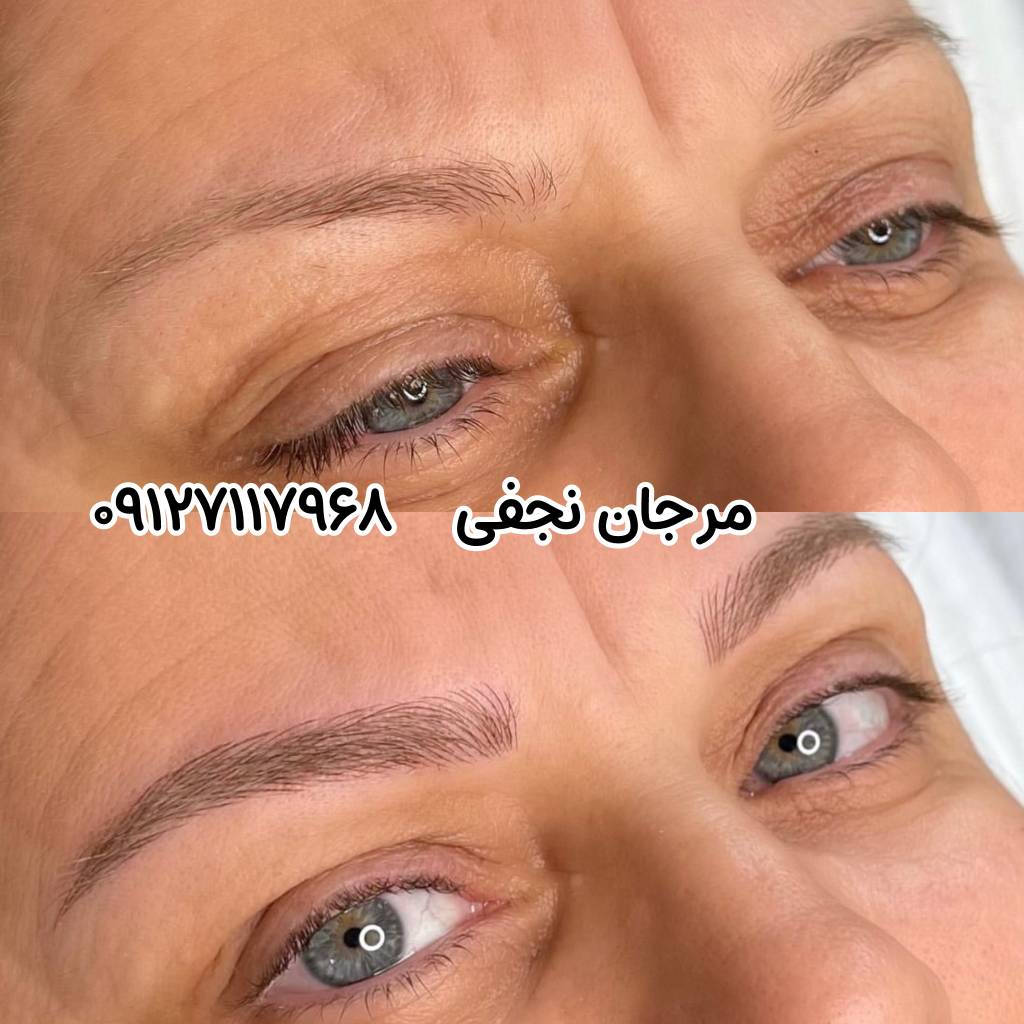 فرق فیبروز ابرو با میکروبلیدینگ 5 تفاوت عوارض فیبروز ابرو و میکروبلیدینگ